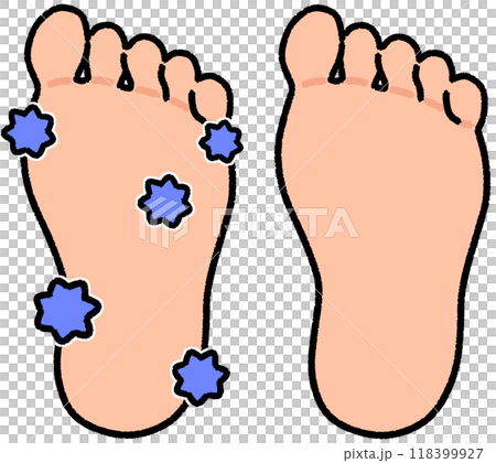 菌だらけの足ときれいな足 菌だらけの足ときれいな足 118399927