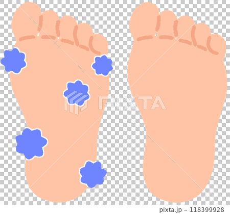 充滿真菌的腳和乾淨的腳 118399928