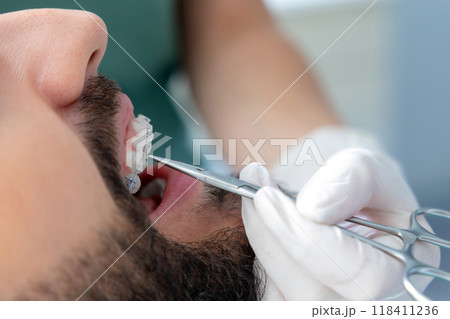 Professional mouth examination and dental treatment checkup in clinic 118411236