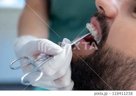 Orthodontic specialist using professional instruments to inspect teeth for caries and provide care 118411238