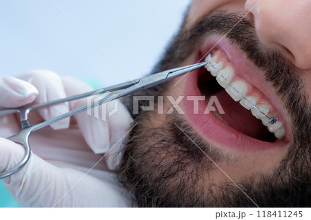 Medical professional oral checkup with dental equipment to examine the patient's mouth Medical professional oral checkup with dental equipment to examine the patient's mouth 118411245