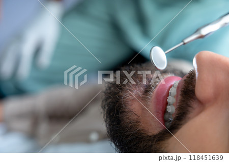 Professional mouth examination and dental treatment checkup in clinic 118451639