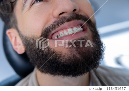 Bearded man patient visiting orthodontist for teeth whitening procedure and dental care Bearded man patient visiting orthodontist for teeth whitening procedure and dental care 118451657