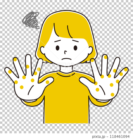 手上有濕疹的婦女的插圖 118461094