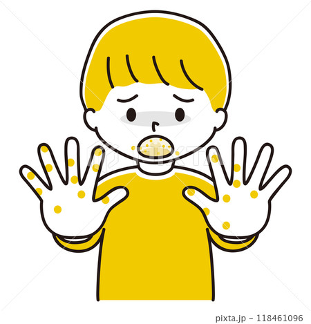 口と手に湿疹ができた男の子のイラスト 118461096