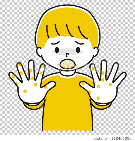 口と手に湿疹ができた男の子のイラスト 118461096