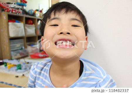 乳歯から永久歯への生え変わり 乳歯から永久歯への生え変わり 118482337