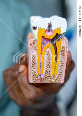 Orthodontic model used in dental education, showing the human tooth anatomy Orthodontic model used in dental education, showing the human tooth anatomy 118506181
