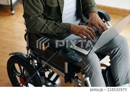 Office Worker With Disability Typing On Laptop 118532973