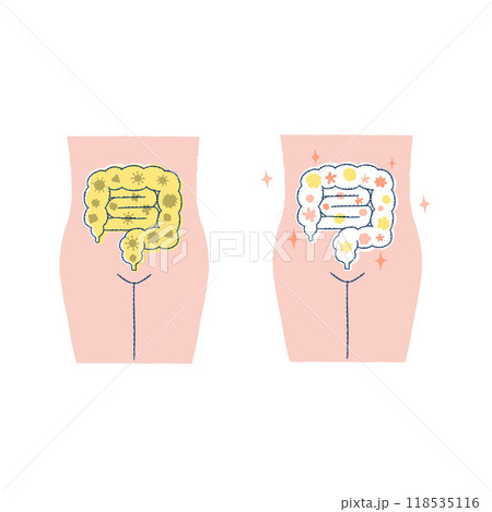 健康な腸内環境・不健康な腸内環境 118535116