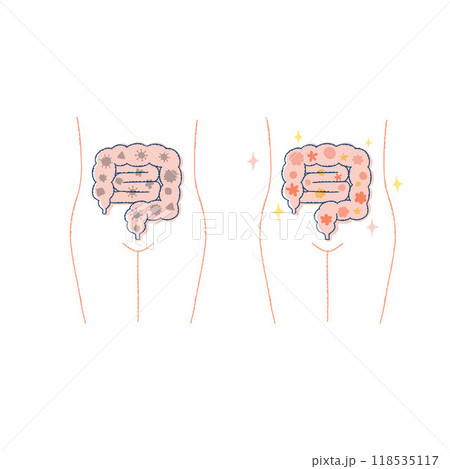 健康な腸内環境・不健康な腸内環境 118535117