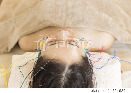 美容鍼をする若い女性 美容鍼をする若い女性 118546894