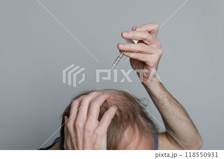 Bald man with minoxidil dropper or essential oil closeup Bald man with minoxidil dropper or essential oil closeup 118550931