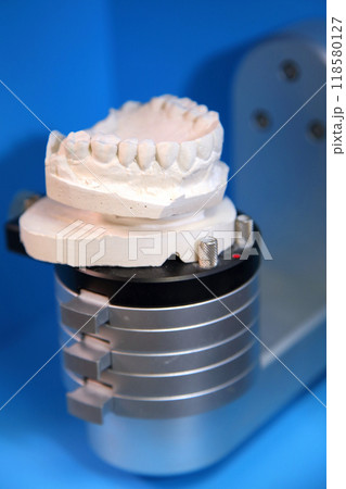 Ceramic dental crowns for implants. Fabrication of dental crowns and dentures made of ceramic. Scanning of plaster casts of teeth. 118580127