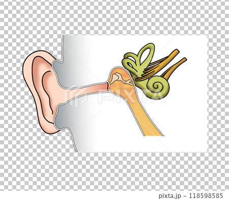 Acute otitis media (no text) 118598585