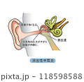 滲出性中耳炎（文字あり） 118598588