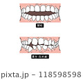 歯列矯正が必要な歯並びPart2 118598598