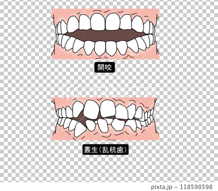 歯列矯正が必要な歯並びPart2 歯列矯正が必要な歯並びPart2 118598598