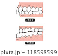 歯列矯正が必要な歯並びPart3 118598599