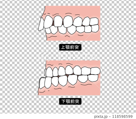 歯列矯正が必要な歯並びPart3 118598599