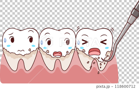 Illustration cartoon of removing tartar from the teeth. Illustration cartoon of removing tartar from the teeth. 118600712
