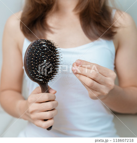 Hair loss problem, Balding , Beauty treatments and health care concepts asian woman holding holding comb with hair loss, young female hold hairbrush and brushing with fall hair from scalp 118607218