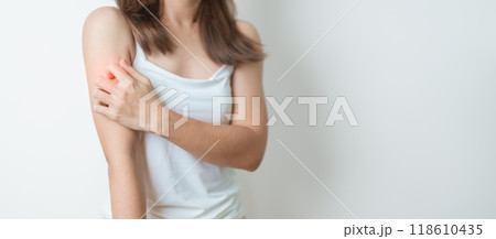 woman itching and scratching itchy arm. Sensitive Skin Allergic reaction to insect bite, food, drug dermatitis. Dermatology, Leprosy day, Systemic lupus erythematosus, Allergy symptoms and rash Eczema 118610435
