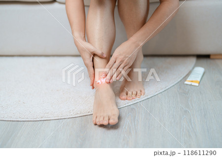 Arthritis and Muscle Pain Relief Cream concept. woman having leg pain due to Ankle Sprains or Achilles Tendonitis and Shin Splints ache. injuries, health and medical concept Arthritis and Muscle Pain Relief Cream concept. woman having leg pain due to Ankle Sprains or Achilles Tendonitis and Shin Splints ache. injuries, health and medical concept 118611290