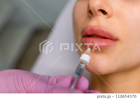 Injection procedure for lip augmentation, close-up. The cosmetologist slowly and carefully injects filler into the client lips. Advertising concept for facial care, youth and beauty Injection procedure for lip augmentation, close-up. The cosmetologist slowly and carefully injects filler into the client lips. Advertising concept for facial care, youth and beauty 118654370