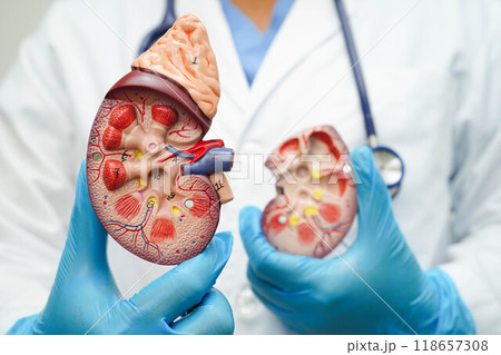 Chronic kidney disease, doctor with model for treatment urinary system, urology, Estimated glomerular filtration rate eGFR. 118657308