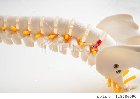 Spinal nerve and bone, Lumbar spine displaced herniated disc fragment, Model for treatment medical in the orthopedic department. Spinal nerve and bone, Lumbar spine displaced herniated disc fragment, Model for treatment medical in the orthopedic department. 118686690