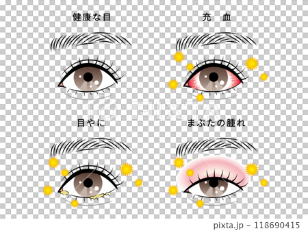 眼部問題套裝（花粉） 118690415