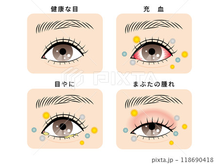目のトラブルセット（花粉とハウスダスト） 118690418
