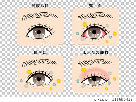 目のトラブルセット（花粉とハウスダスト） 118690418