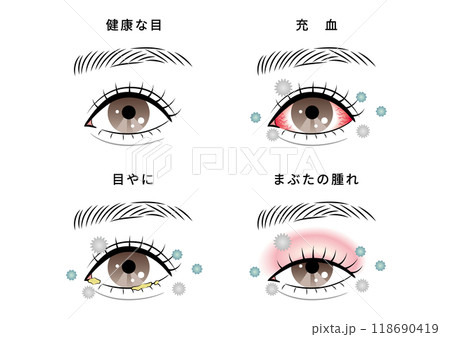 目のトラブルセット（ハウスダスト） 118690419