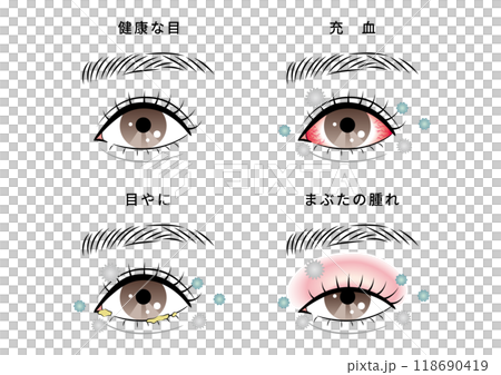 Eye trouble set (house dust) 118690419