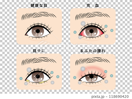 Eye trouble set (house dust) Eye trouble set (house dust) 118690420