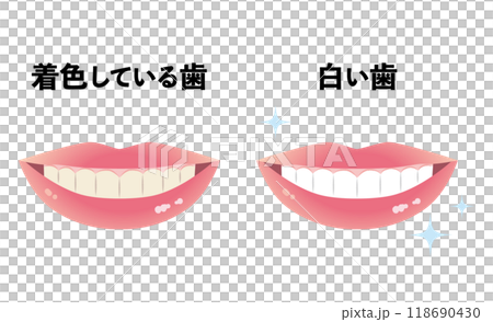 彩色牙齒和白色牙齒 118690430