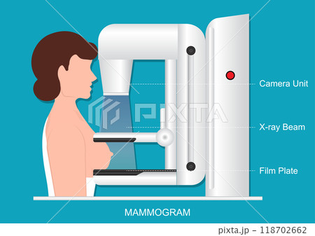 Mammography also called mastography DICOM modality or MG. Mammography also called mastography DICOM modality or MG. 118702662