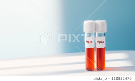 Two test tubes labeled 'Mpox' filled with red liquid in a sterile laboratory setting. Healthcare research on monkeypox virus. 118821470