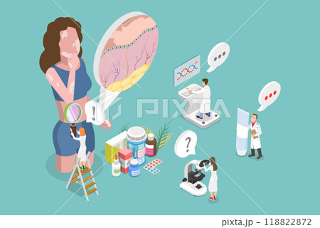 3D Isometric Flat Vector Illustration of Vitiligo, Diagnosis And Treatment 118822872