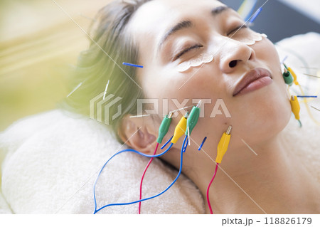 鍼電極低周波治療器を使って美容鍼をする若い女性 118826179