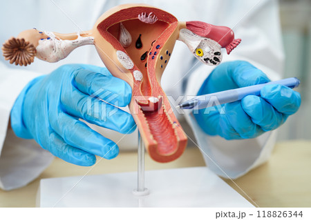 Uterus, doctor holding human anatomy model for study diagnosis and treatment in hospital. 118826344