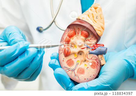 Kidney disease, Chronic kidney disease ckd, Doctor hold human model to treat and study in hospital. Kidney disease, Chronic kidney disease ckd, Doctor hold human model to treat and study in hospital. 118834397
