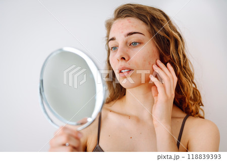 Cute woman with rashes on her face looks into a small mirror. Natural beauty. Cosmetology, care. 118839393