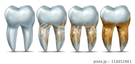 Tooth Disease Growth Tooth Disease Growth 118852661