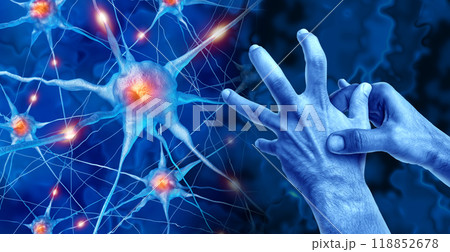 Parkinson's Disease Parkinson's Disease 118852678