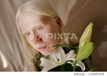 High angle view medium closeup of young woman with albinism posing for portrait with beautiful white lilium flowers 118883544