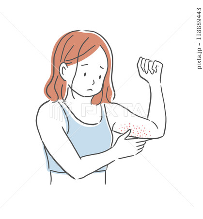 肌荒れした二の腕を気にする女性のイラスト素材 肌荒れした二の腕を気にする女性のイラスト素材 118889443