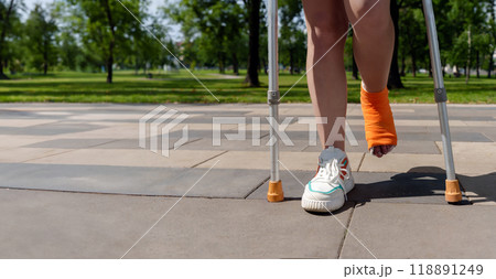 plaster-encased leg with an orange bandage, accompanied by the presence of crutches in the serene summer park environment 118891249